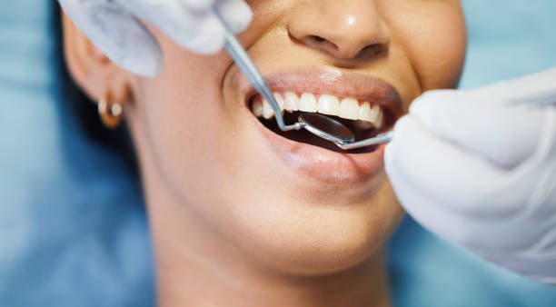 Best Emergency Cosmetic Dentistry (e.g., broken veneers) in Terrace Park, OH