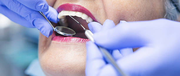 Best Emergency Denture Repair in Terrace Park, OH